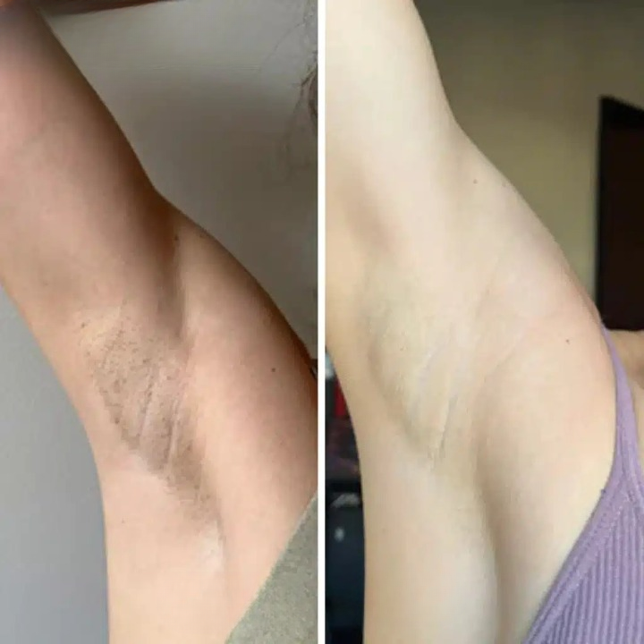 Gel esfoliante clareador